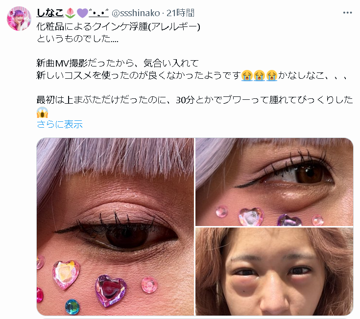 しなこ 顔